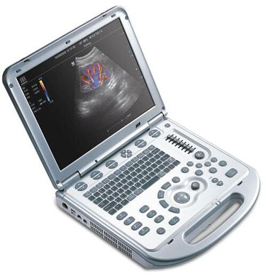 Chiropractic Alexandria VA Muscuoloskeletal Ultrasound